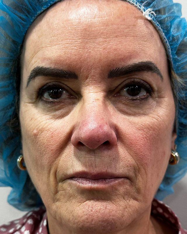Before photo of patient's skin